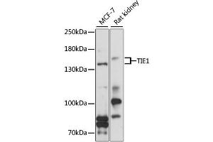 Western blot analysis of extracts of various cell lines, using TIE1 antibody (ABIN6292318) at 1:1000 dilution. (TIE1 抗体)