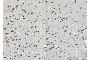 ABIN6265926 and ABIN6272455 at 1/100 staining Rat brain tissue by IHC-P. (USP36 抗体  (Internal Region))