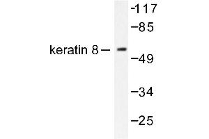 Image no. 1 for anti-Keratin 8 (KRT8) antibody (ABIN265503) (KRT8 抗体)