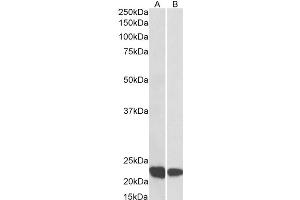 Western Blotting (WB) image for anti-Ras-Related C3 Botulinum Toxin Substrate 2 (Rho Family, Small GTP Binding Protein Rac2) (RAC2) antibody (ABIN5907554) (RAC2 抗体)
