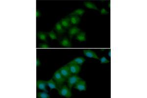 ICC/IF analysis of Visfatin in HeLa cells line, stained with DAPI (Blue) for nucleus staining and monoclonal anti-human Visfatin antibody (1:100) with goat anti-mouse IgG-Alexa fluor 488 conjugate (Green). (NAMPT 抗体)