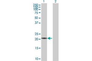 Western Blot analysis of MED18 expression in transfected 293T cell line by MED18 MaxPab polyclonal antibody. (MED18 抗体  (AA 1-208))