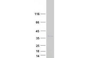 Western Blotting (WB) image for Spindle and Kinetochore Associated Complex Subunit 1 (SKA1) (Transcript Variant 2) protein (Myc-DYKDDDDK Tag) (ABIN2732101)