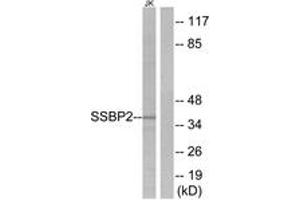 Western blot analysis of extracts from Jurkat cells, using SSBP2 Antibody. (SSBP2 抗体  (AA 10-59))