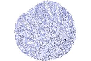 KLK7 staining is absent in all cells of the colon mucosa (Kallikrein 7 抗体)