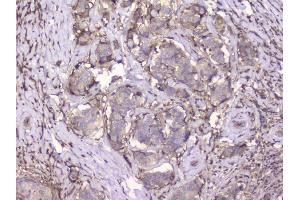 IHC analysis of Beta 2 Microglobulin using anti-Beta 2 Microglobulin antibody (ABIN6719452). (beta-2 Microglobulin 抗体  (AA 22-119))