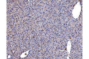 IHC analysis of Poliovirus Receptor/PVR using anti-Poliovirus Receptor/PVR antibody (ABIN7601072). (Poliovirus Receptor 抗体  (AA 28-331))