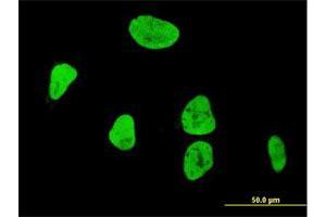 Immunofluorescence of monoclonal antibody to RUNX1 on HeLa cell. (RUNX1 抗体  (AA 210-310))