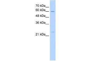 WB Suggested Anti-GINS1 Antibody Titration:  5. (GINS1 抗体  (N-Term))