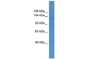 WB Suggested Anti-Abcc12 Antibody Titration:  0. (ABCC12 抗体  (Middle Region))