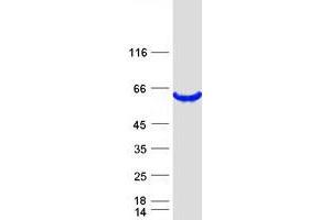 Western Blotting (WB) image for GDP Dissociation Inhibitor 1 (GDI1) protein (Myc-DYKDDDDK Tag) (ABIN2730259)