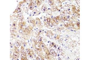 Immunohistochemistry of paraffin-embedded Human liver using CYP3A4 Polyclonal Antibody at dilution of 1:100 (40x lens). (CYP3A4 抗体)