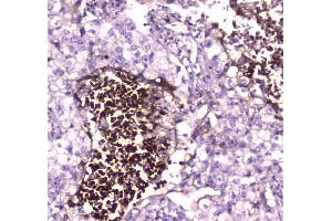 IHC analysis of Lactoferrin using anti-Lactoferrin antibody . (Lactoferrin 抗体  (AA 529-710))
