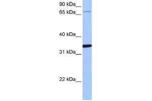 WB Suggested Anti-PCDHA10 Antibody Titration:  0.