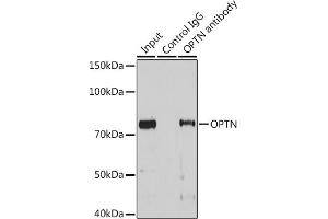 Immunoprecipitation analysis of 25 μg extracts of Mouse heart cells using 3 μg OPTN antibody (ABIN3015612, ABIN3015613, ABIN3015614 and ABIN6218972). (OPTN 抗体  (AA 1-577))