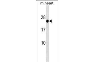 HOXB7 Antibody (Center) (ABIN1538701 and ABIN2838284) western blot analysis in mouse heart tissue lysates (35 μg/lane). (HOXB7 抗体  (AA 93-121))