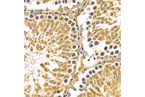 Immunohistochemistry of paraffin-embedded Rat testis using PIBF1 antibody at dilution of 1:100 (x400 lens). (PIBF1 抗体)