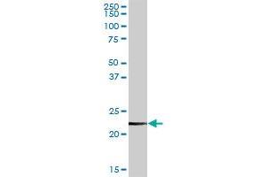 CLTB MaxPab rabbit polyclonal antibody. (CLTB 抗体  (AA 1-211))
