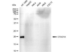 anti-Cancer/testis Antigen 1A (CTAG1A) antibody