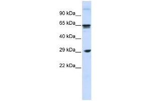 CLEC4M antibody used at 1 ug/ml to detect target protein. (C-Type Lectin Domain Family 4, Member M (CLEC4M) (N-Term) 抗体)