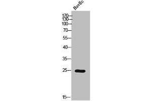 Western Blot analysis of HuvEc cells using Phospho-Casein Kinase IIβ (S209) Polyclonal Antibody (CSNK2B 抗体  (pSer209))