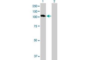 Western Blot analysis of STAT6 expression in transfected 293T cell line by STAT6 MaxPab polyclonal antibody. (STAT6 抗体  (AA 1-847))
