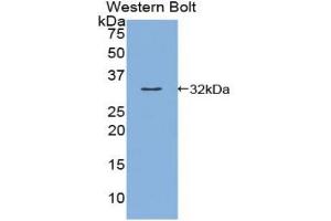 Western blot analysis of the recombinant protein. (Kallikrein 9 抗体  (AA 1-254))