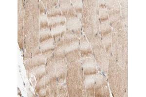 ABIN6266499 at 1/200 staining human skeletal muscle tissue sections by IHC-P. (BAK1 抗体  (N-Term))