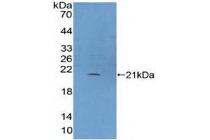 Figure. (Phospholipase C beta 3, Phosphoinositide Specific (AA 318-468) 抗体)