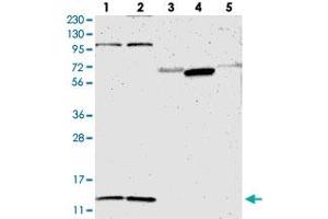 Western blot analysis of Lane 1: RT-4, Lane 2: U-251 MG, Lane 3: Human Plasma, Lane 4: Liver, Lane 5: Tonsil with MRPL52 polyclonal antibody  at 1:250-1:500 dilution. (MRPL52 抗体)