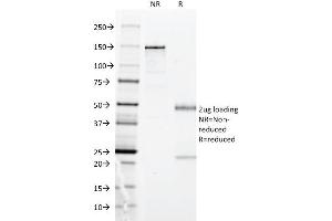 SDS-PAGE Analysis Purified HLA-DP Mouse Monoclonal Antibody (BRA-FB6). (HLA-DPB1 抗体)