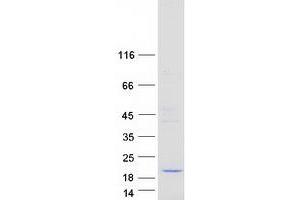 Western Blotting (WB) image for HD Domain Containing 3 (HDDC3) protein (Myc-DYKDDDDK Tag) (ABIN2722529)