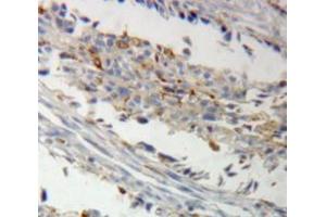 Used in DAB staining on fromalin fixed paraffin-embedded ovary tissue (AKAP12 抗体  (AA 1485-1782))