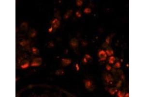 Immunofluorescence analysis of LIN28A antibody with paraffin-embedded human testis tissue. (LIN28A 抗体)