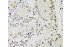 Immunohistochemistry of paraffin-embedded Human stomach using RUVBL1 Polyclonal Antibody at dilution of 1:100 (40x lens). (RUVBL1 抗体)