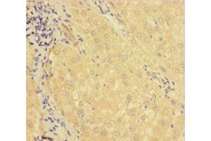 Immunohistochemistry of paraffin-embedded human liver tissue using ABIN7158728 at dilution of 1:100 (KDM1B 抗体  (AA 451-544))