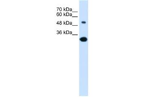 Western Blotting (WB) image for anti-Solute Carrier Family 2 (Facilitated Glucose/fructose Transporter), Member 5 (SLC2A5) (Middle Region) antibody (ABIN2777140)