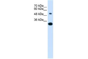 WB Suggested Anti-SLC2A5 Antibody Titration:  0. (SLC2A5 抗体  (Middle Region))
