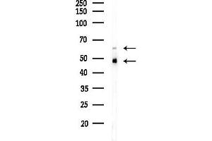 anti-Splicing Factor 3b, Subunit 4, 49kDa (SF3B4) (N-Term) antibody
