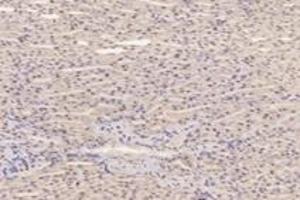 Immunohistochemistry analysis of paraffin-embedded mouse kidney using,PFDN4 (ABIN7075171) at dilution of 1: 4200 (PFDN4 抗体)
