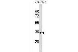DYT1 Antibody ABIN1539945 western blot analysis in ZR-75-1 cell line lysates (35 μg/lane). (TOR1A 抗体)