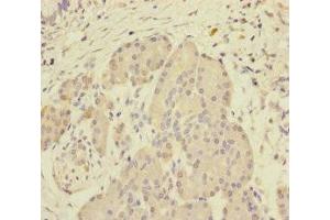Immunohistochemistry of paraffin-embedded human pancreatic tissue using ABIN7168641 at dilution of 1:100 (SCFD1 抗体  (AA 373-642))