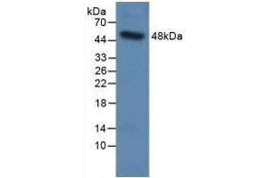 Detection of Recombinant SPC, Human using Polyclonal Antibody to Surfactant Protein C (SP-C) (Surfactant Protein C 抗体  (AA 24-197))