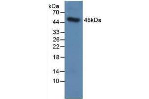 Detection of Recombinant SPC, Human using Polyclonal Antibody to Surfactant Protein C (SP-C)