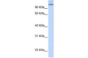 Western Blotting (WB) image for anti-Poly (ADP-Ribose) Polymerase Family, Member 9 (PARP9) antibody (ABIN2458048) (PARP9 抗体)
