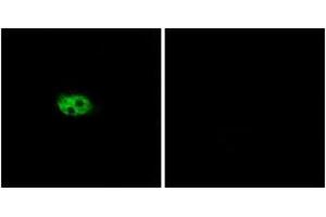Immunofluorescence analysis of A549 cells, using NK3R Antibody. (TACR3 抗体  (AA 401-450))