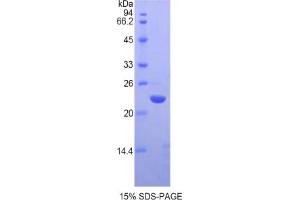 SDS-PAGE analysis of Human Chromobox Homolog 3 Protein.