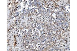 IHC analysis of EHD3 using anti-EHD3 antibody (ABIN7602777). (EHD3 抗体  (C-Term))