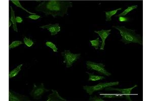 Immunofluorescence (IF) image for anti-Kruppel-Like Factor 4 (Gut) (KLF4) (AA 221-320) antibody (ABIN948792)