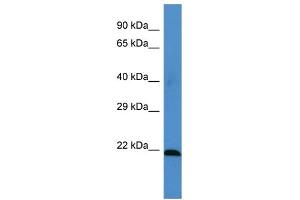 Host: Rabbit Target Name: MSRA Sample Type: HT1080 Whole Cell lysates Antibody Dilution: 1. (MSRA 抗体  (Middle Region))